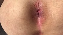 Teen anale gape close-up