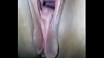 Open vagina
