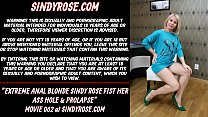 La blonde anale extrême Sindy Rose fist son trou du cul et prolapsus