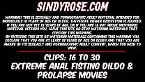 Экстремальный анальный фистинг, дилдо и пролапс Sindy Rose, подборка с 16 по 30