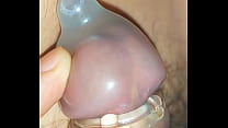 Ejaculation inside a fluid-filled condom